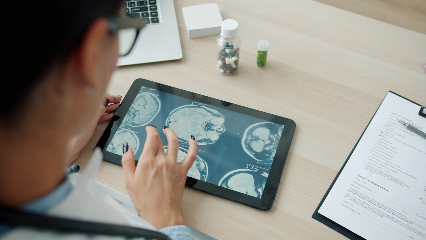 Médico revisando escáneres cerebrales en una tableta en un escritorio.